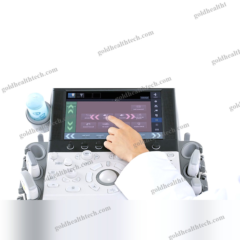 On-Platform Ultrasound System