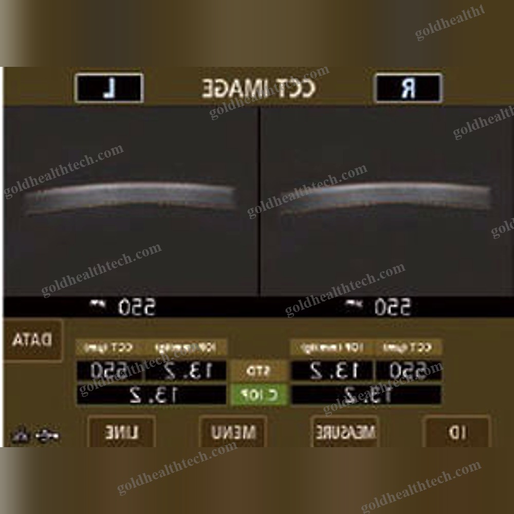 Tonometer
