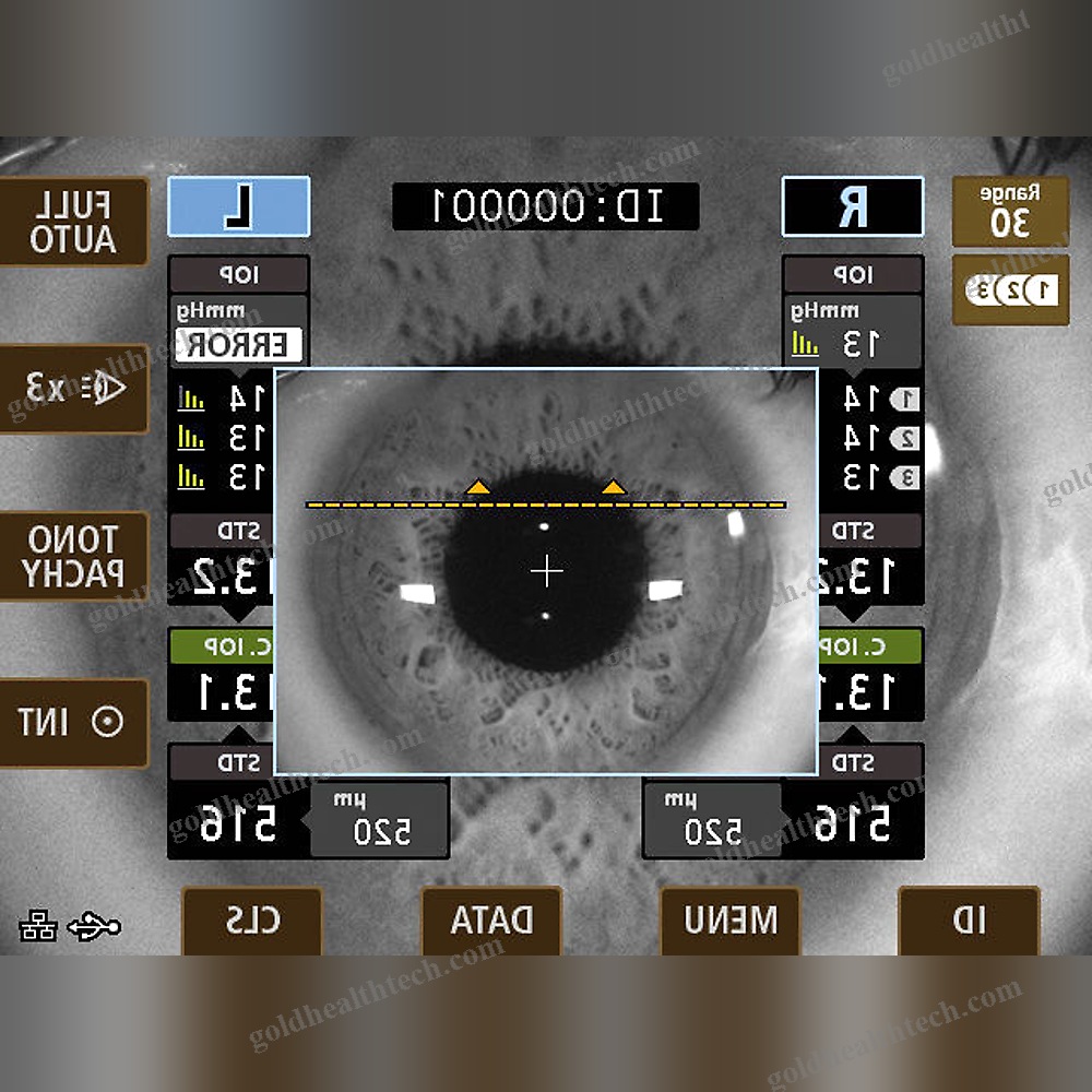 Tonometer