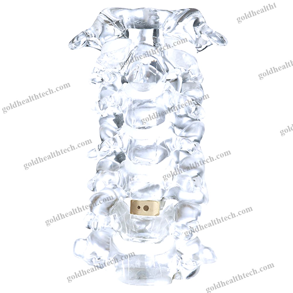 Cervical Interbody Fusion Cage