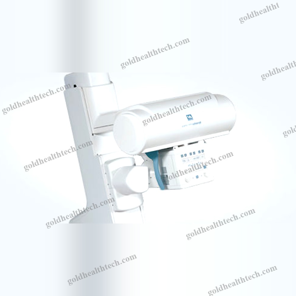 Radio-Fluoroscopy System
