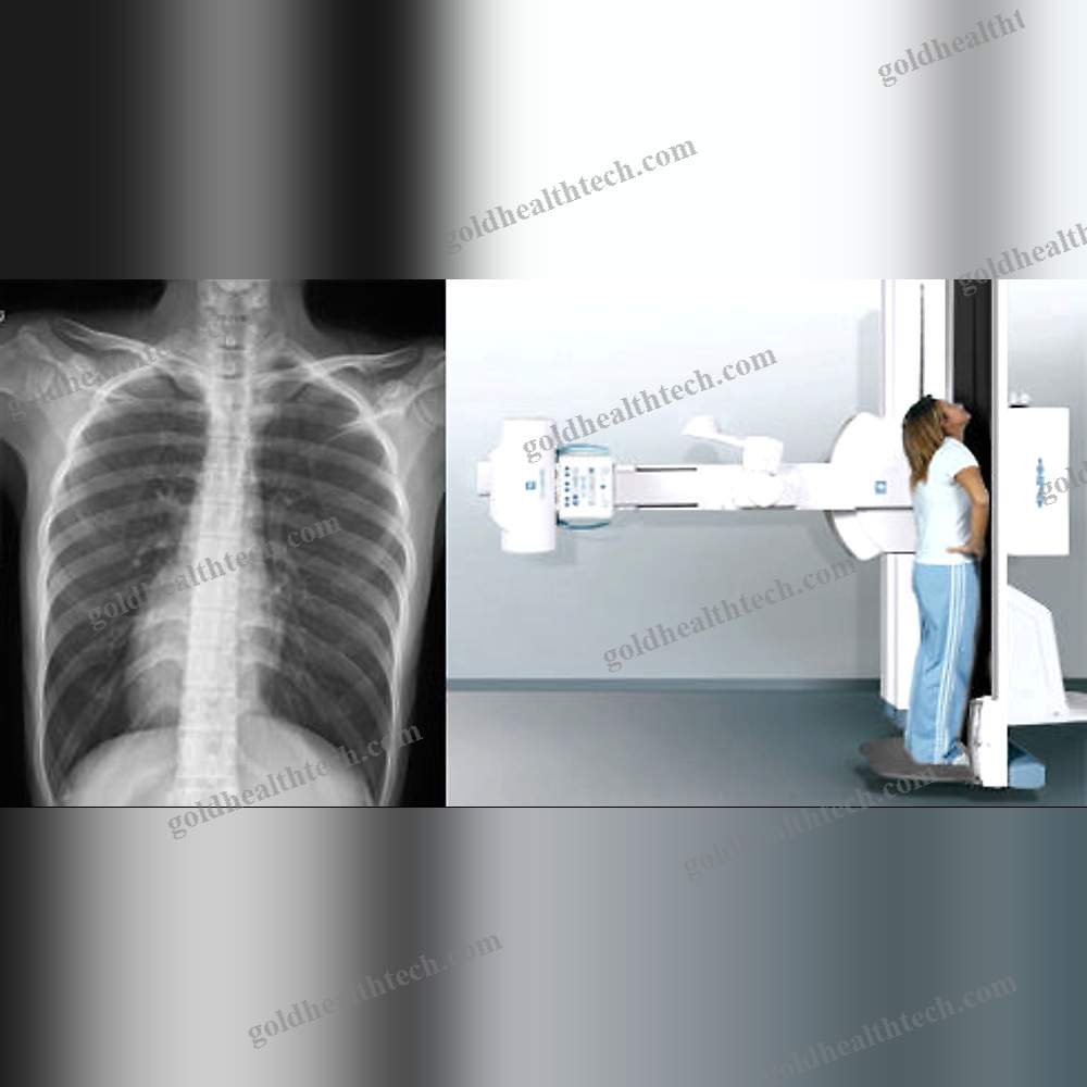 Radio-Fluoroscopy System