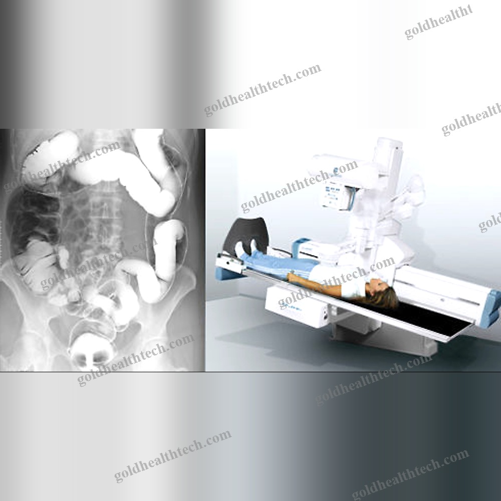 Radio-Fluoroscopy System