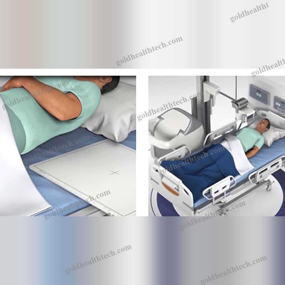 Radiography Acquisition System