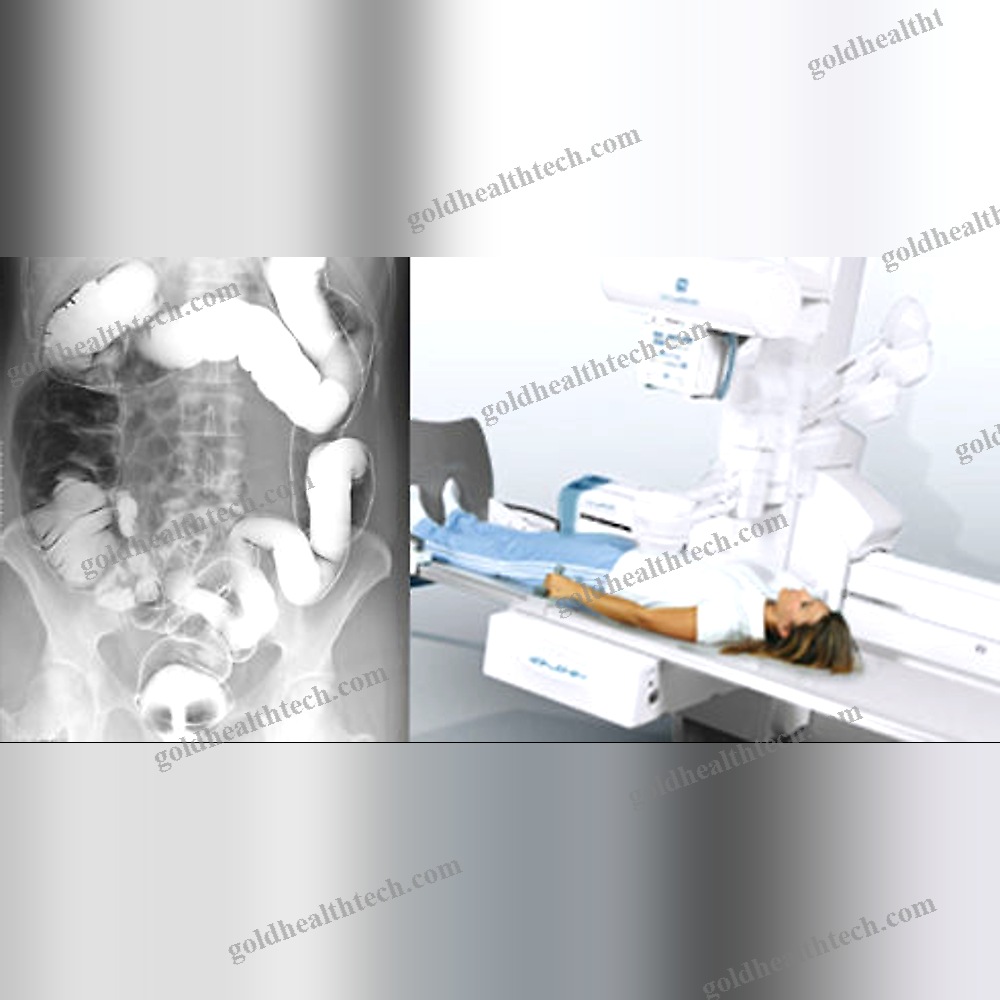 Radio-Fluoroscopy System