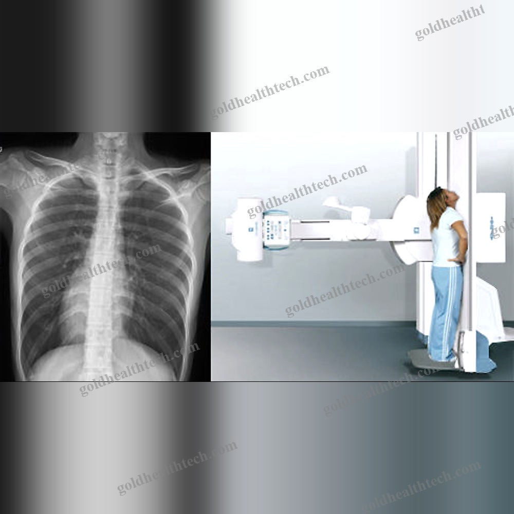 Radio-Fluoroscopy System
