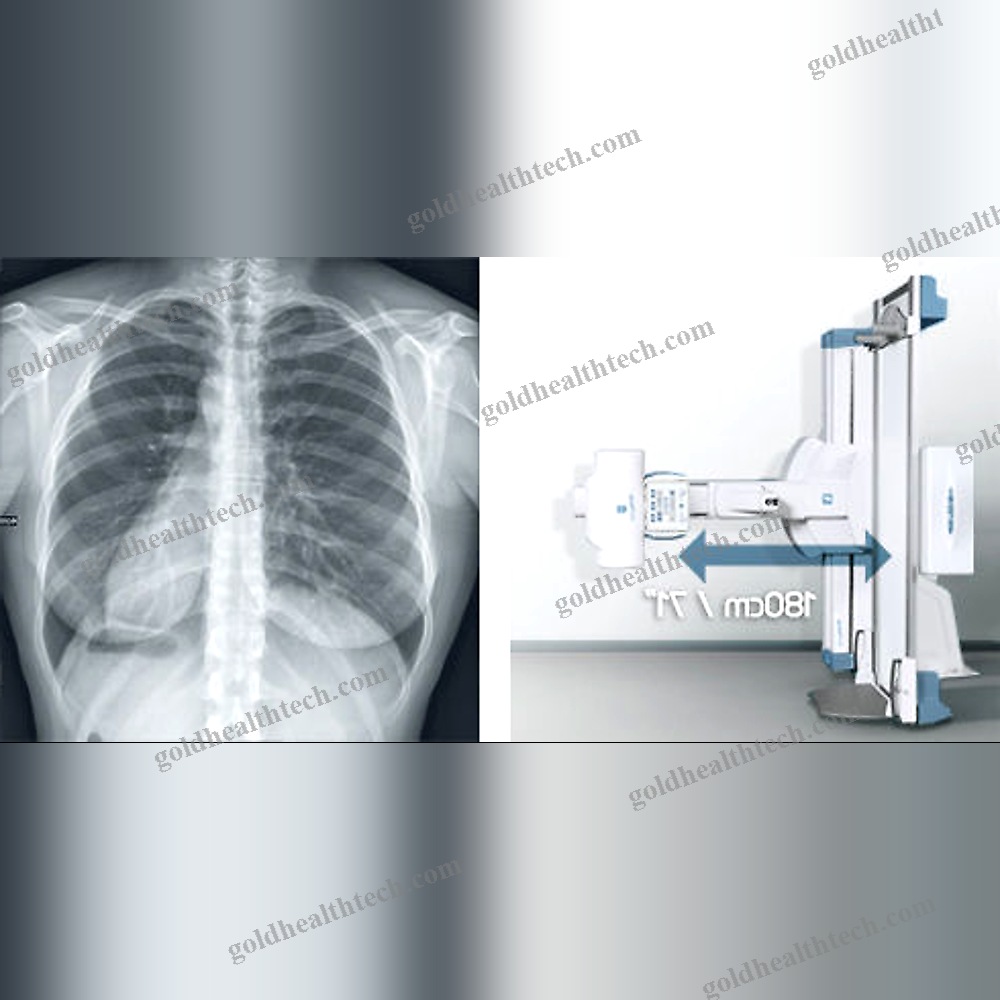 Radio-Fluoroscopy System