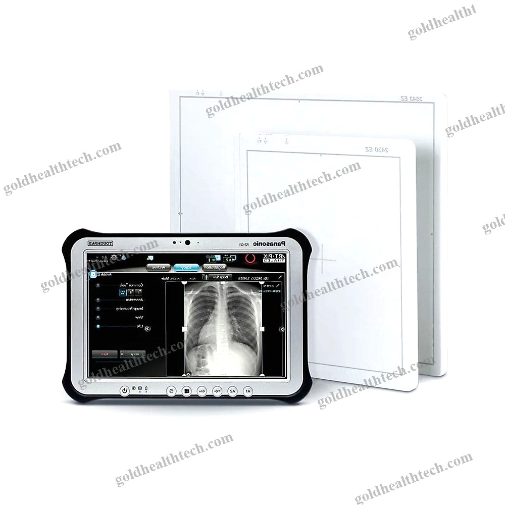 Radiography Acquisition System
