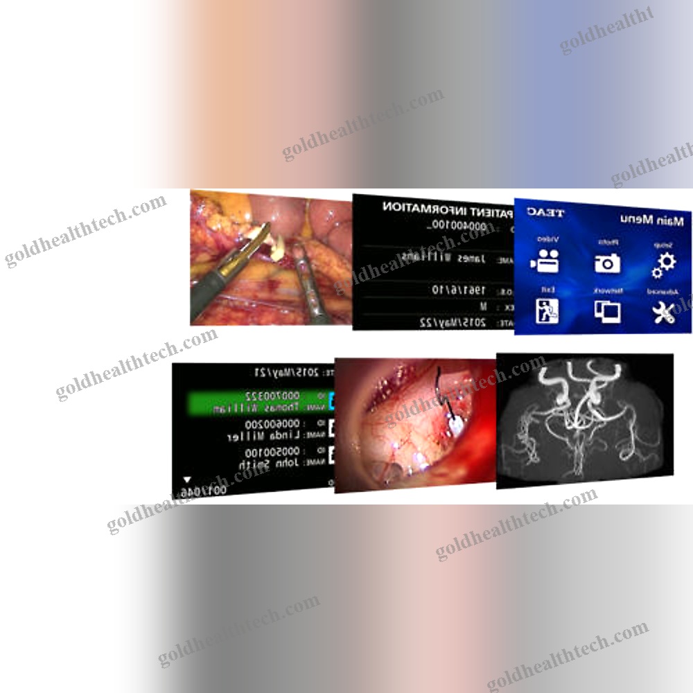 Digestive Endoscopy Video Processor