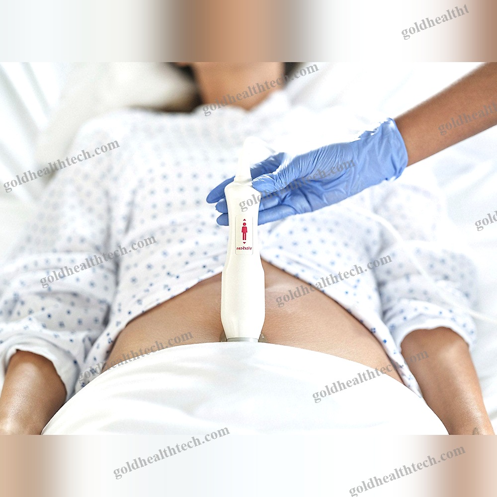 Portable, With Trolley Ultrasound Bladder Scanner
