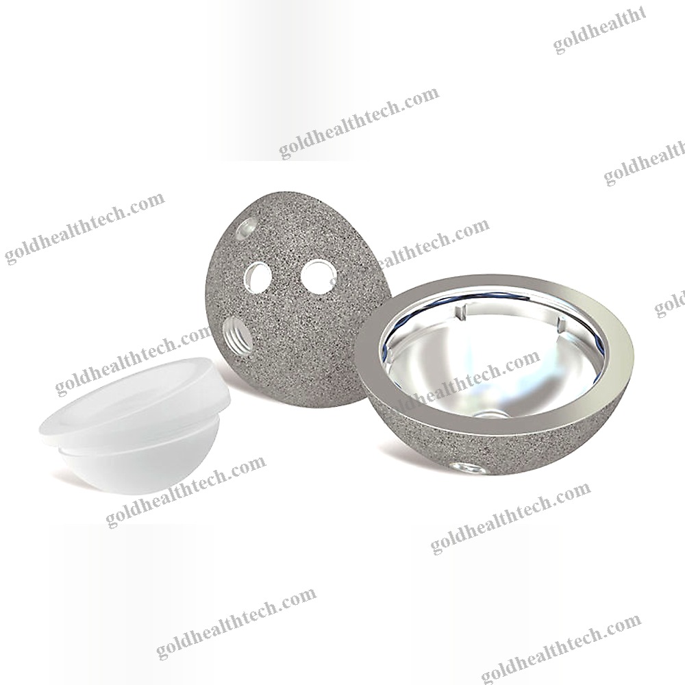 Cementless Acetabular Prosthesis