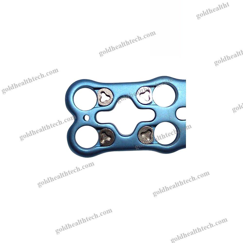 Cervical Arthrodesis Plate