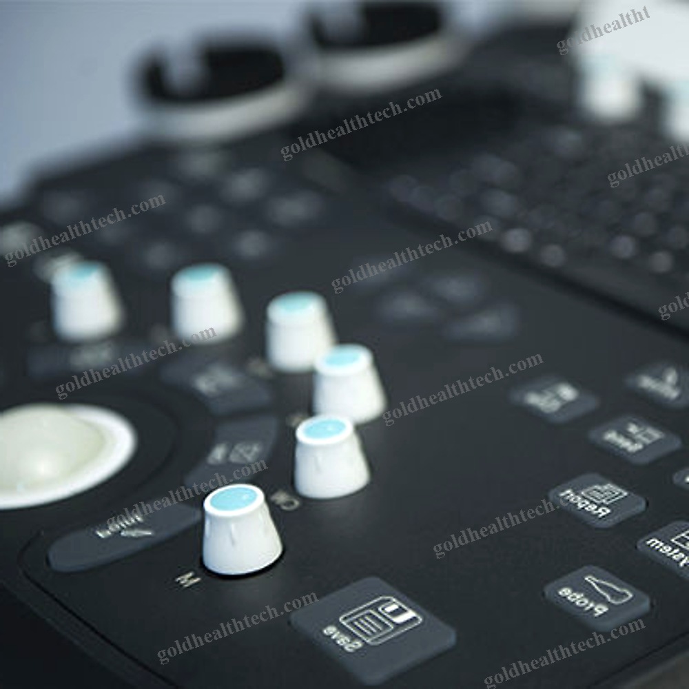 On-Platform Ultrasound System