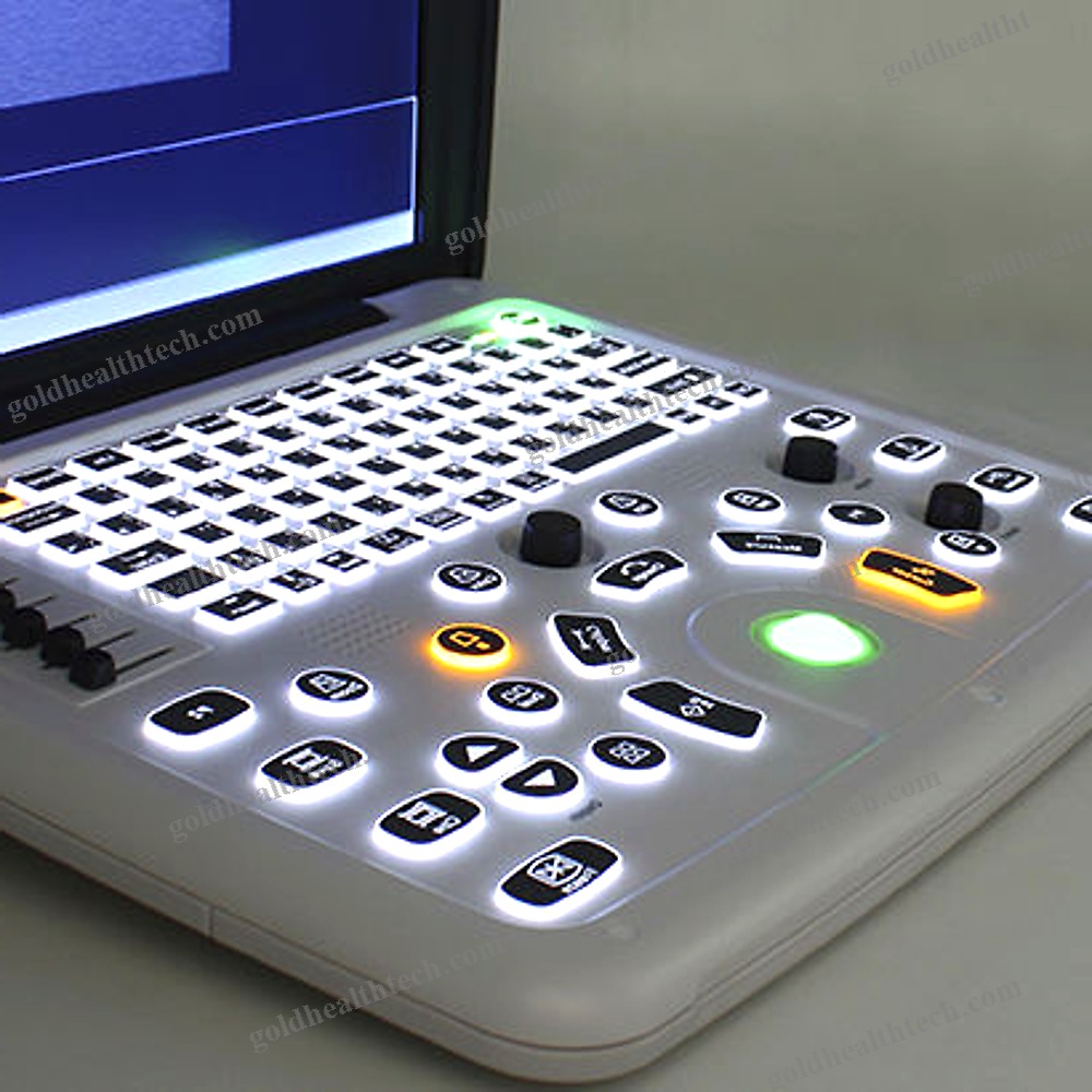 Portable Ultrasound System