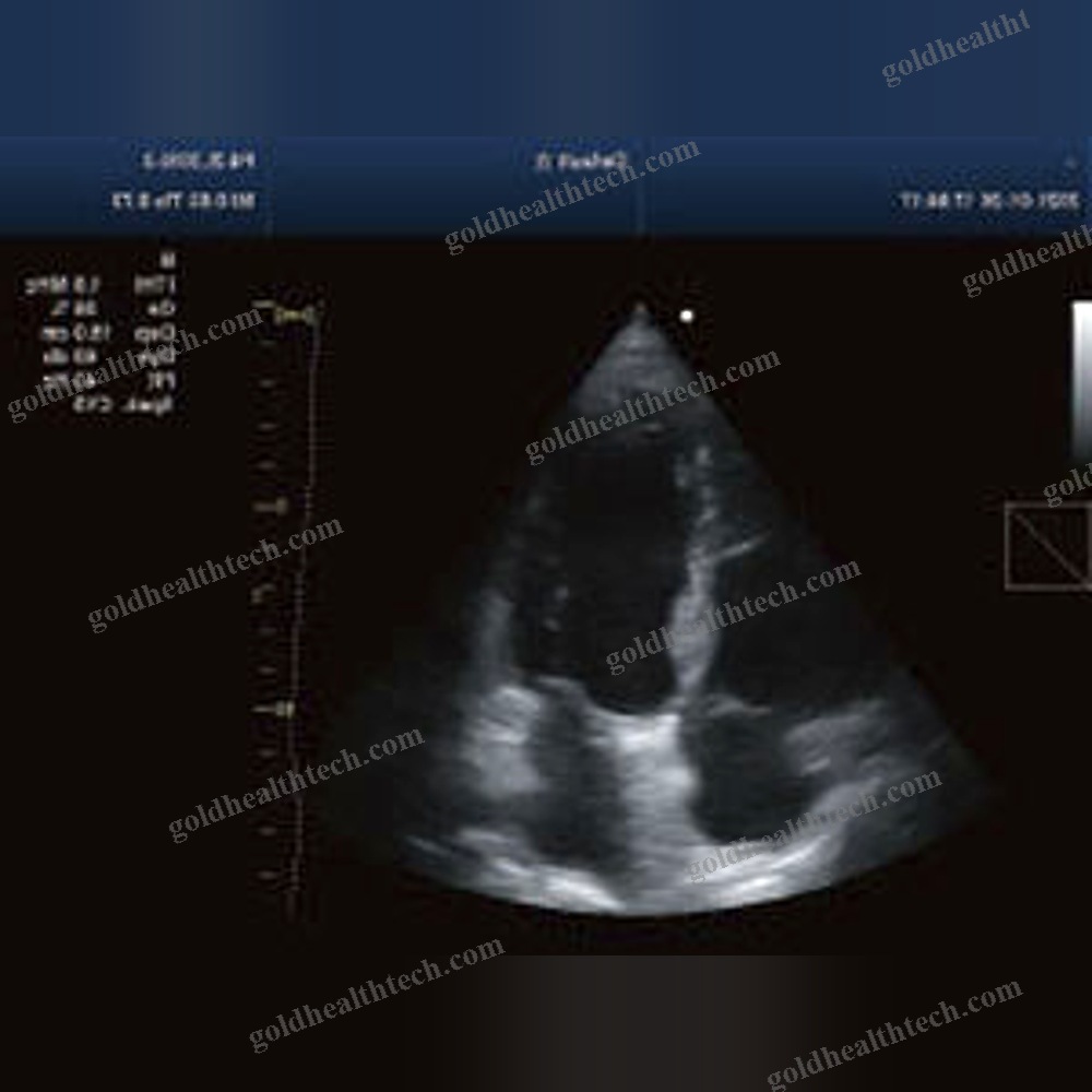 On-Platform Ultrasound System