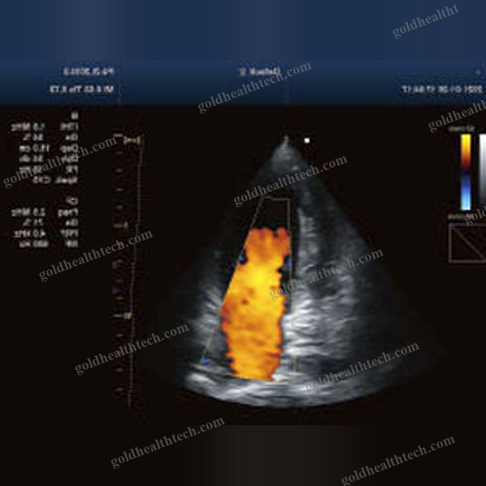 On-Platform Ultrasound System