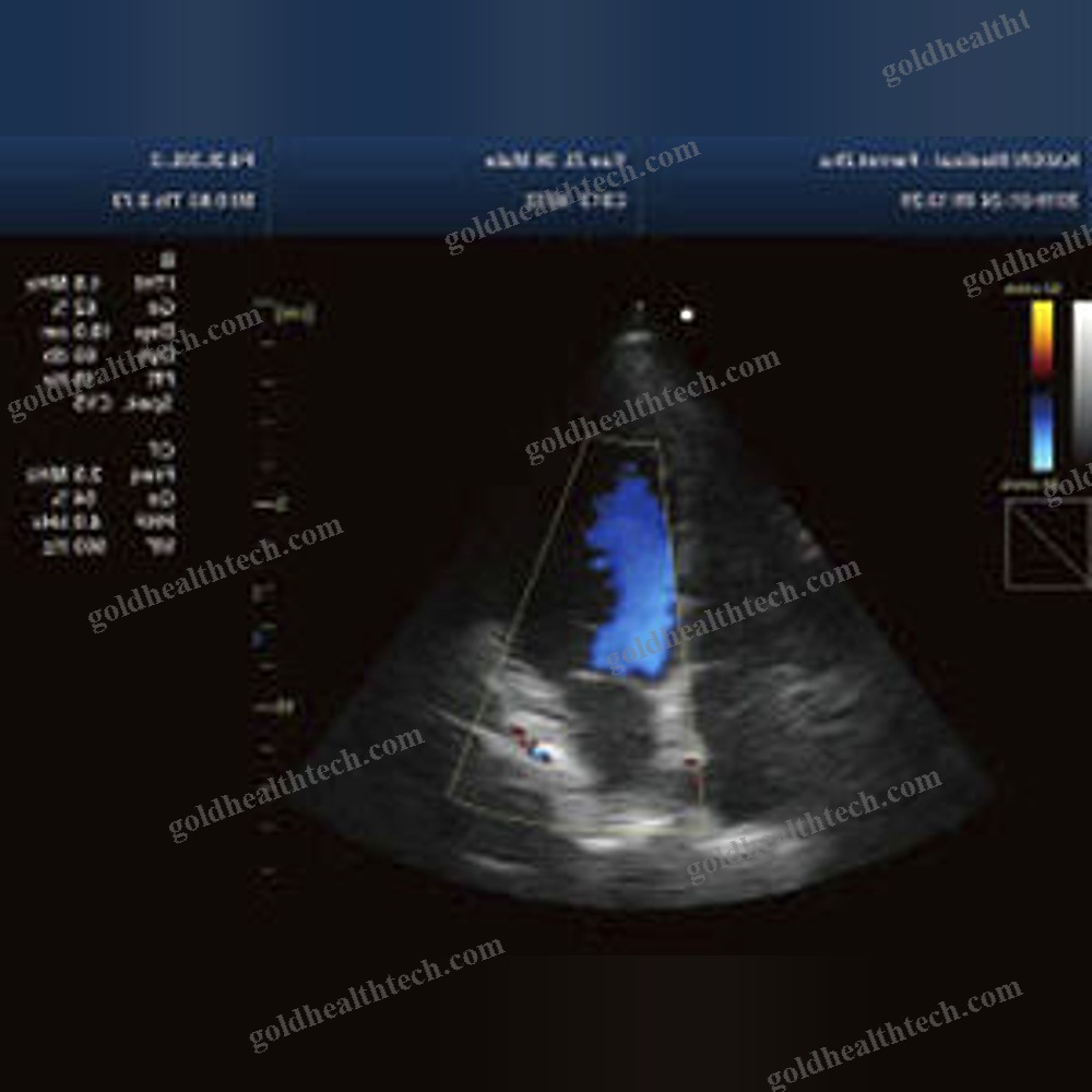 On-Platform Ultrasound System