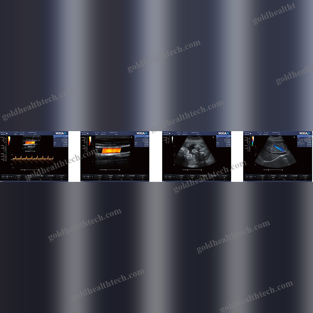 Portable Ultrasound System
