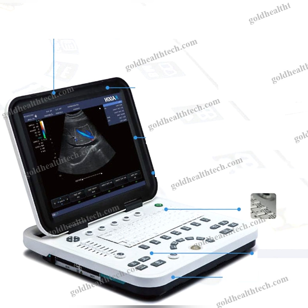 Portable Ultrasound System
