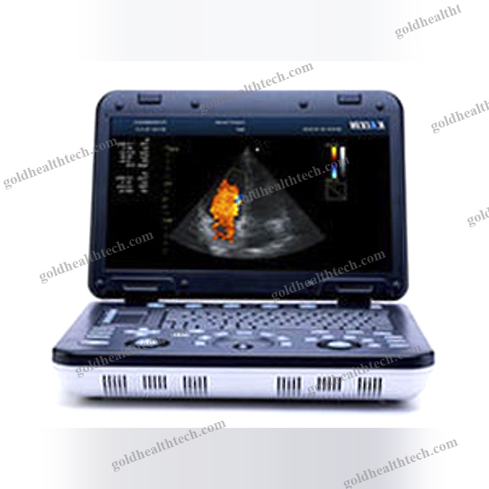 Portable Ultrasound System