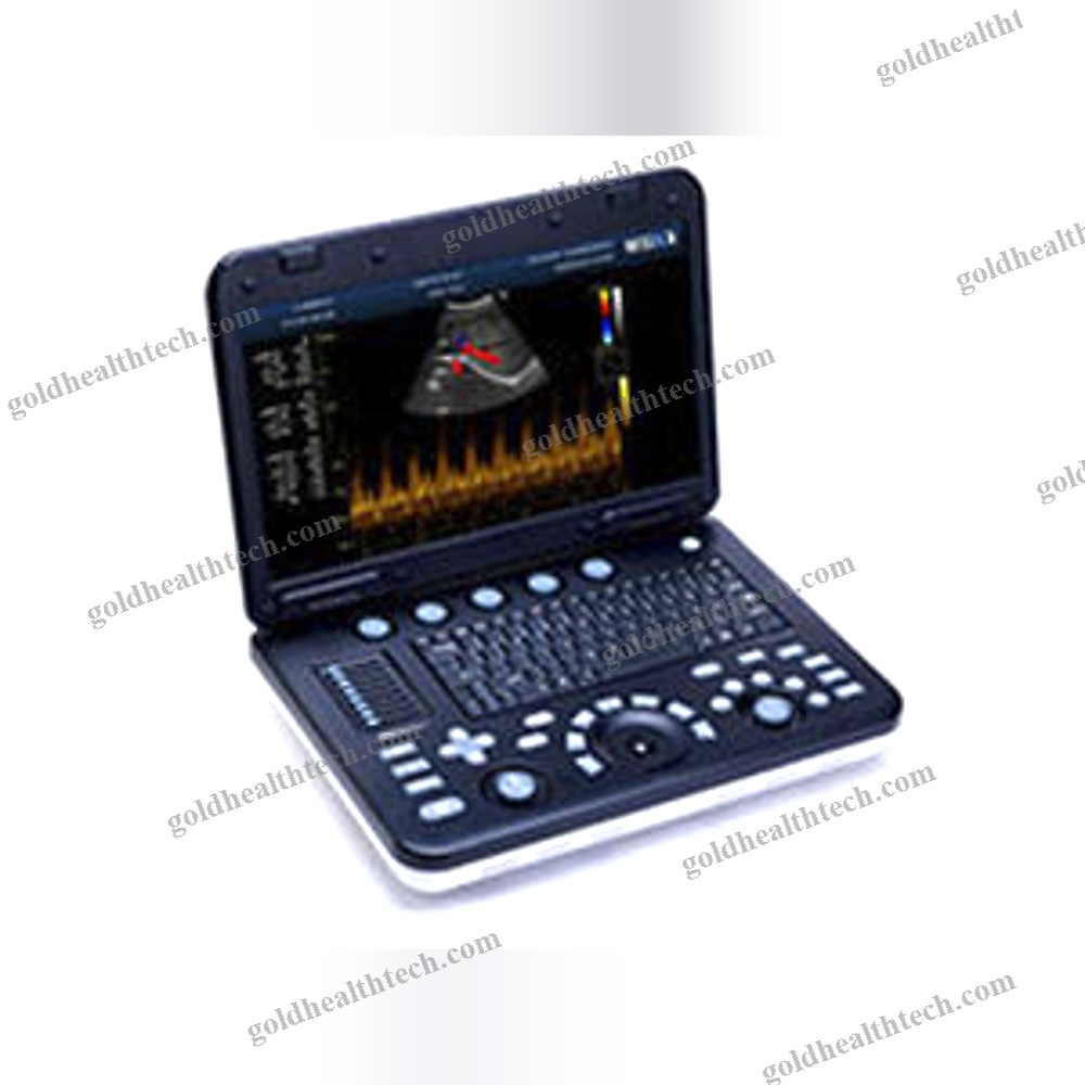 Portable Ultrasound System