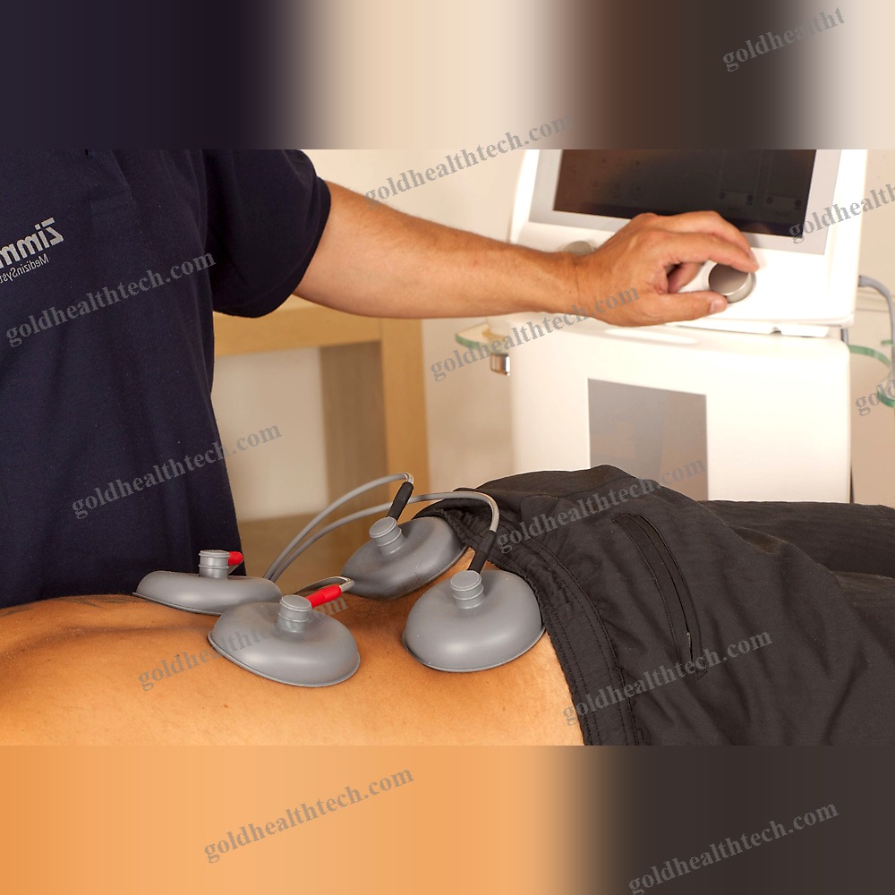 Electric Stimulator
