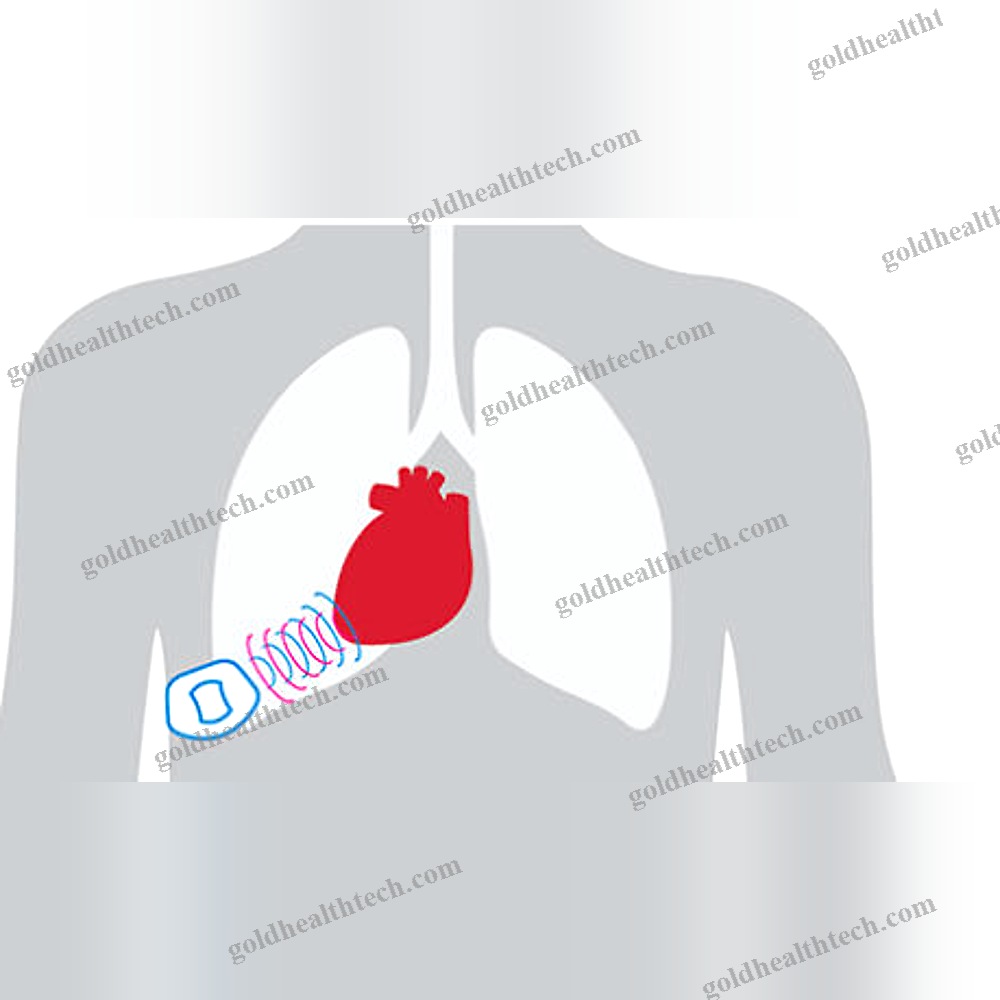 Heart Failure Management System