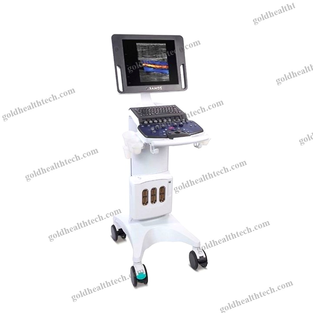 On-Platform, Compact Ultrasound System