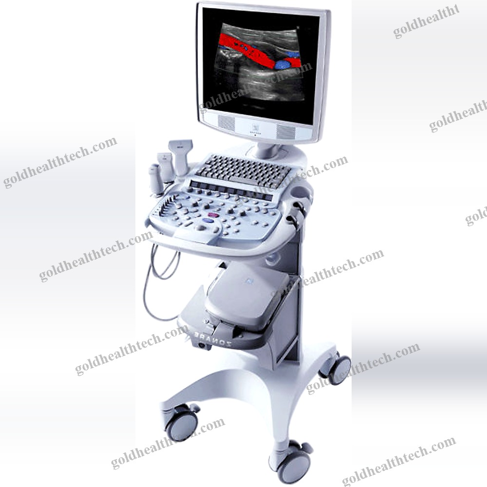 On-Platform, Compact Ultrasound System