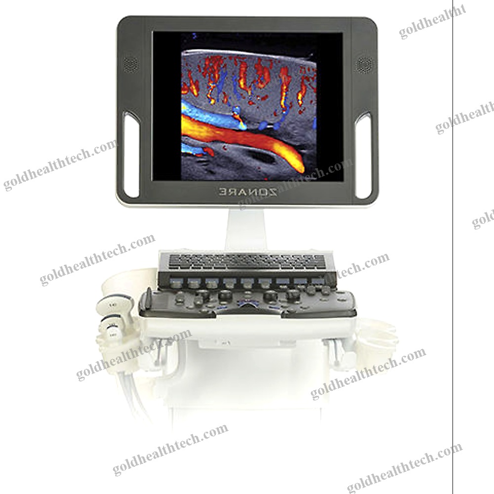 On-Platform, Compact Ultrasound System