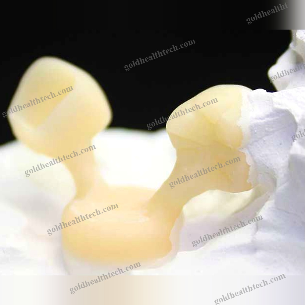 Ceramic Dental Material
