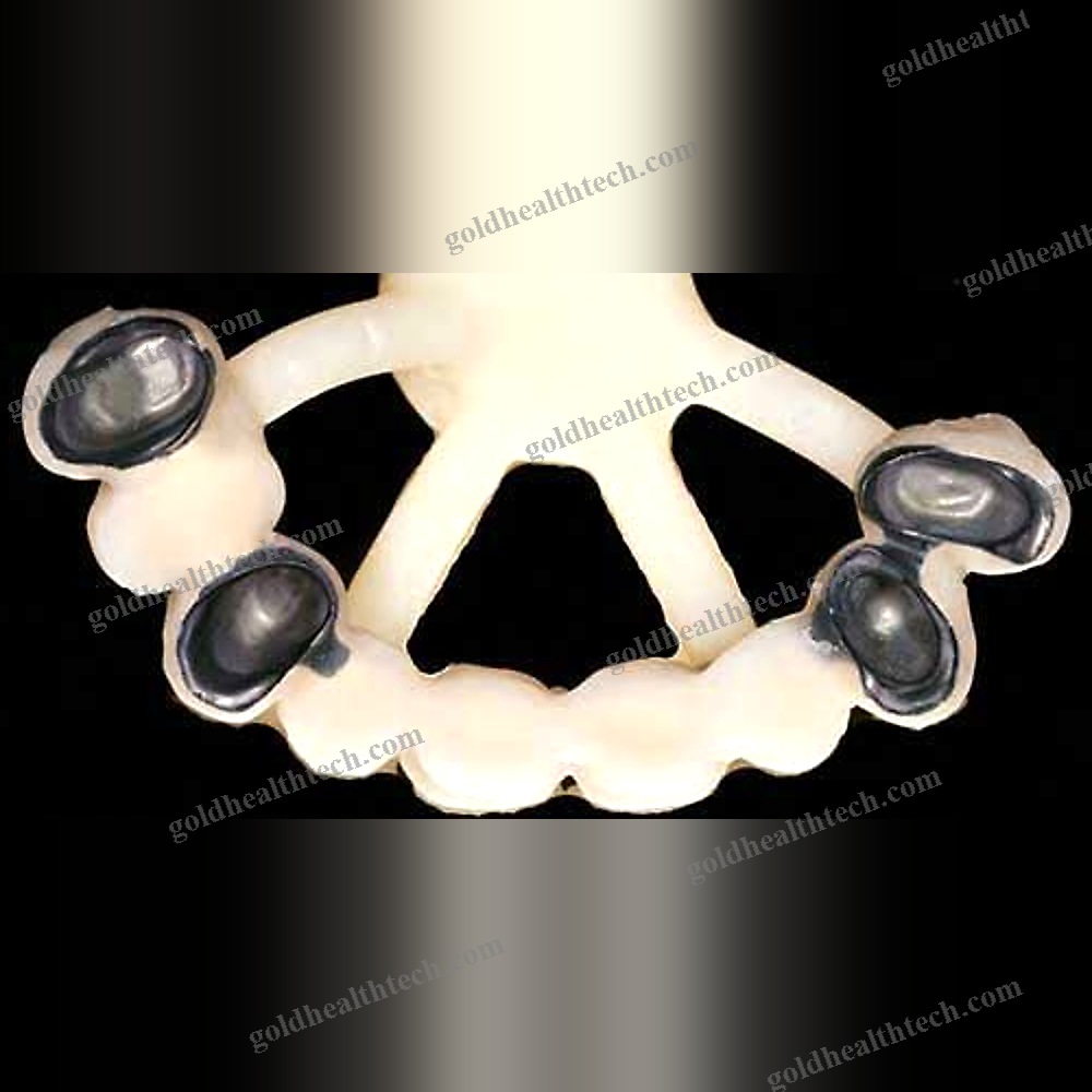 Ceramic Dental Material