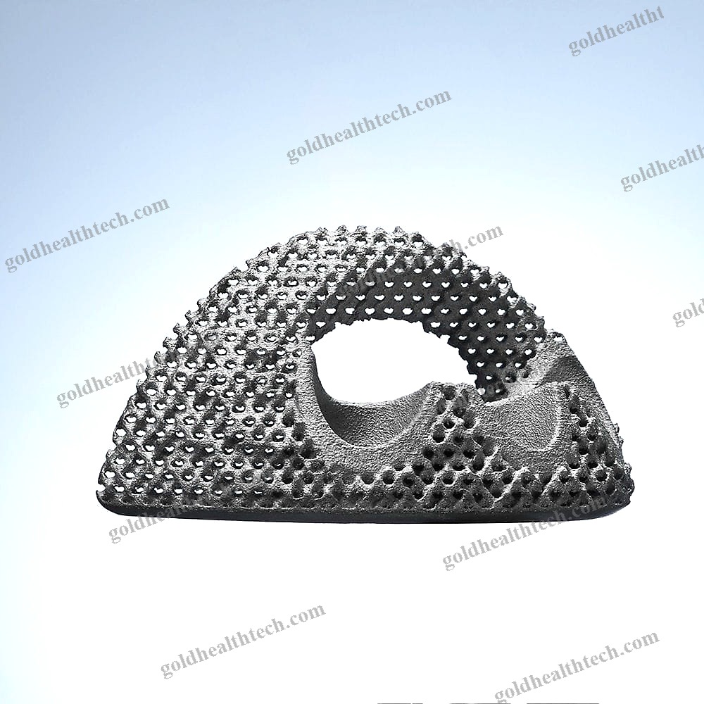 Revision Acetabular Prosthesis