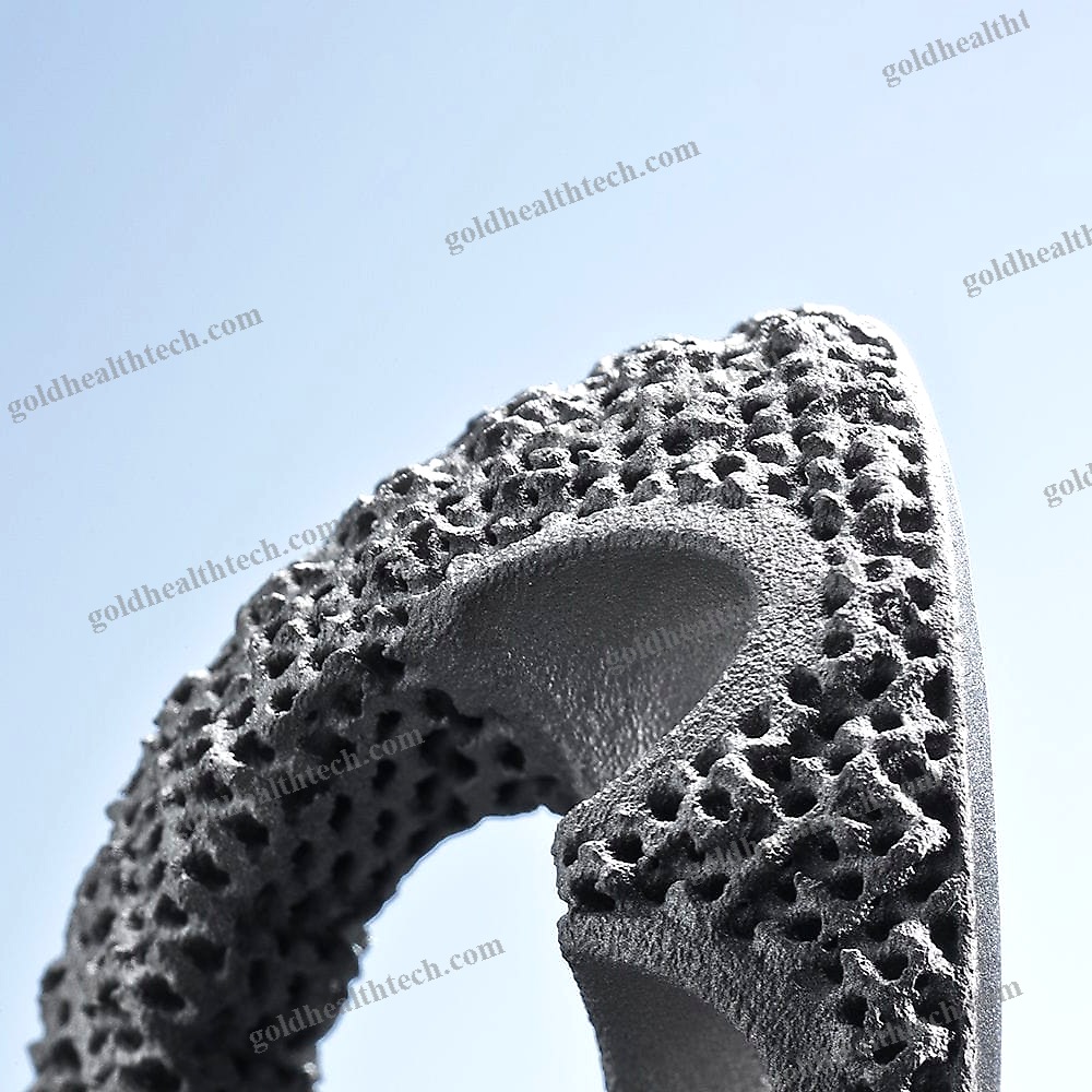 Revision Acetabular Prosthesis
