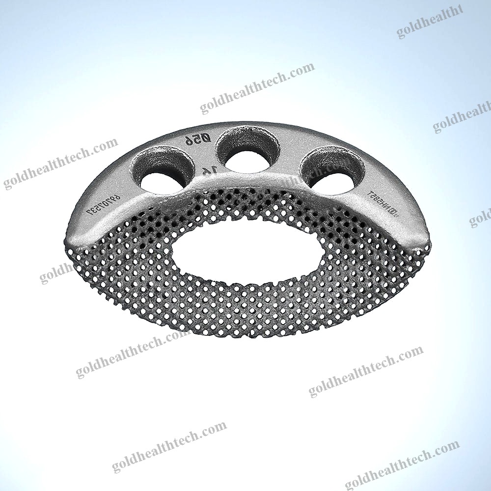 Revision Acetabular Prosthesis