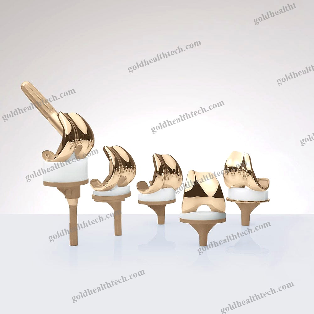 Total Knee Prosthesis