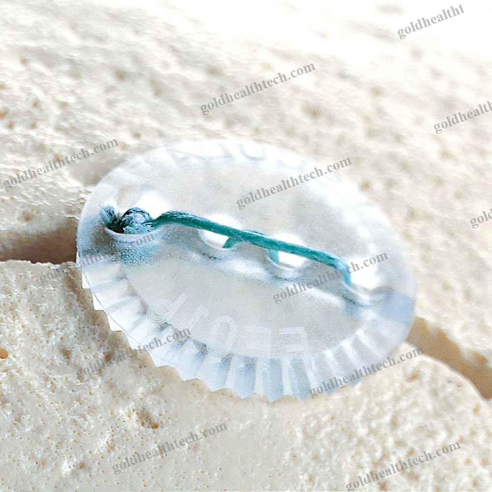 Absorbable Cranial Fixation System