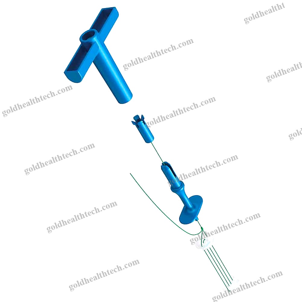 Absorbable Cranial Fixation System