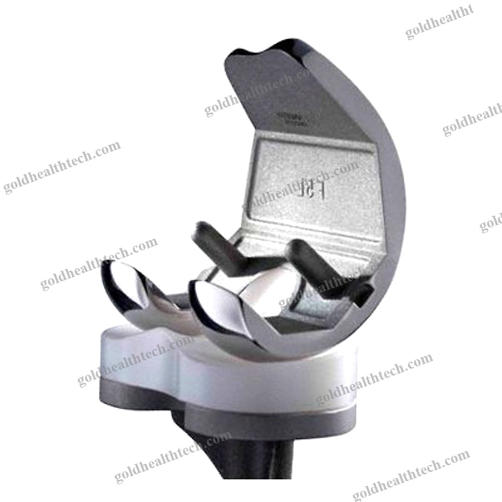Total Knee Prosthesis