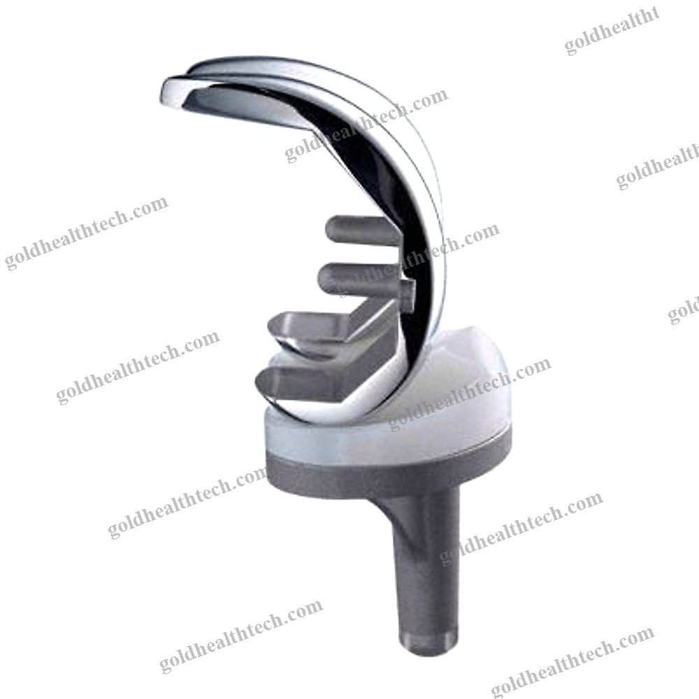 Total Knee Prosthesis