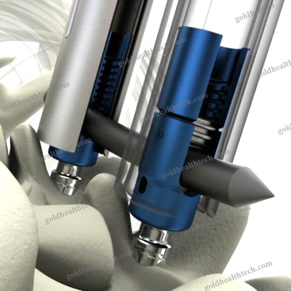 Thoraco-Lumbar Osteosynthesis Unit