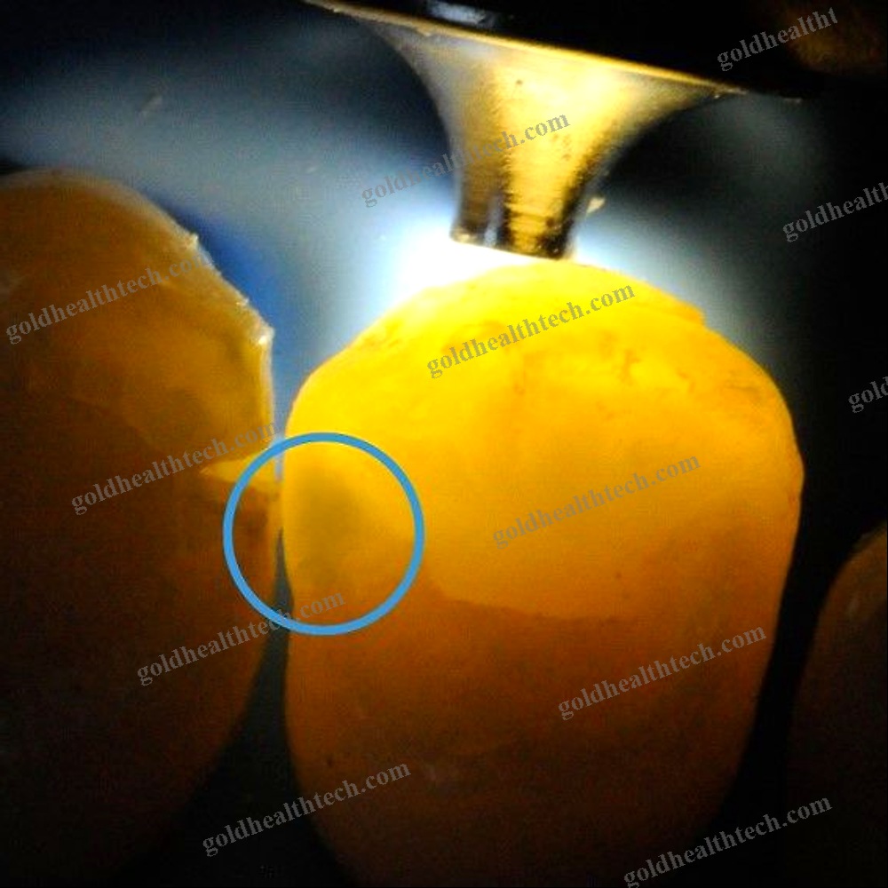 Dental Curing Light