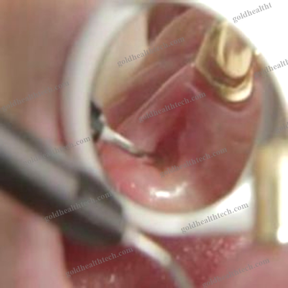 Dental Mirror