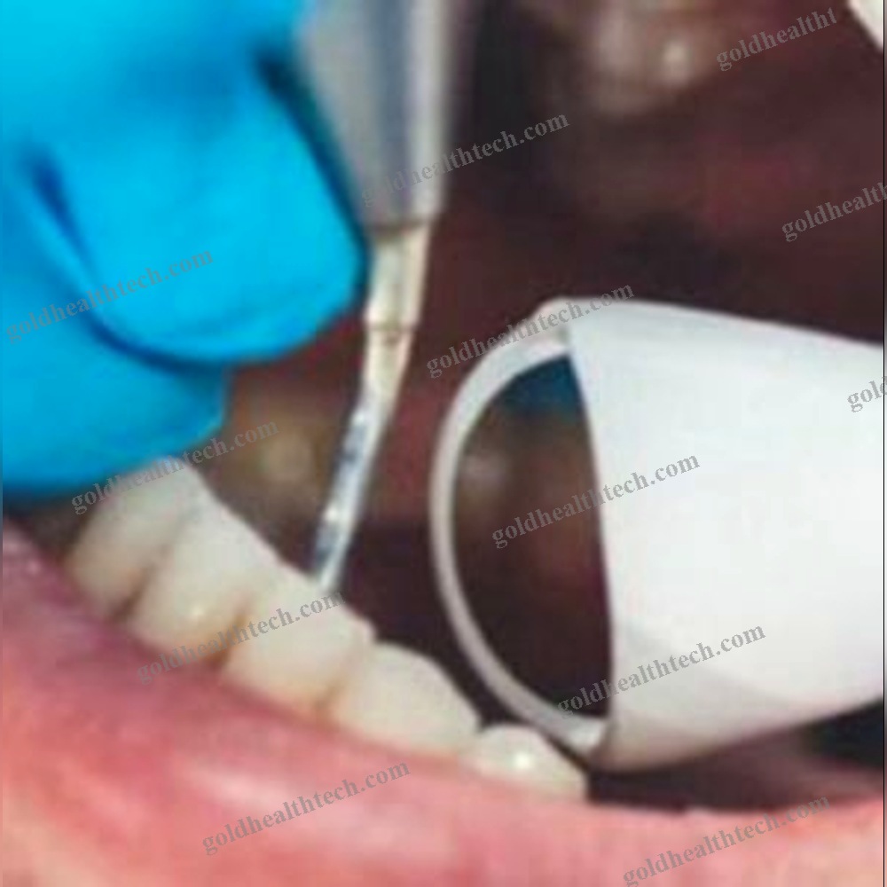 Dental Mirror