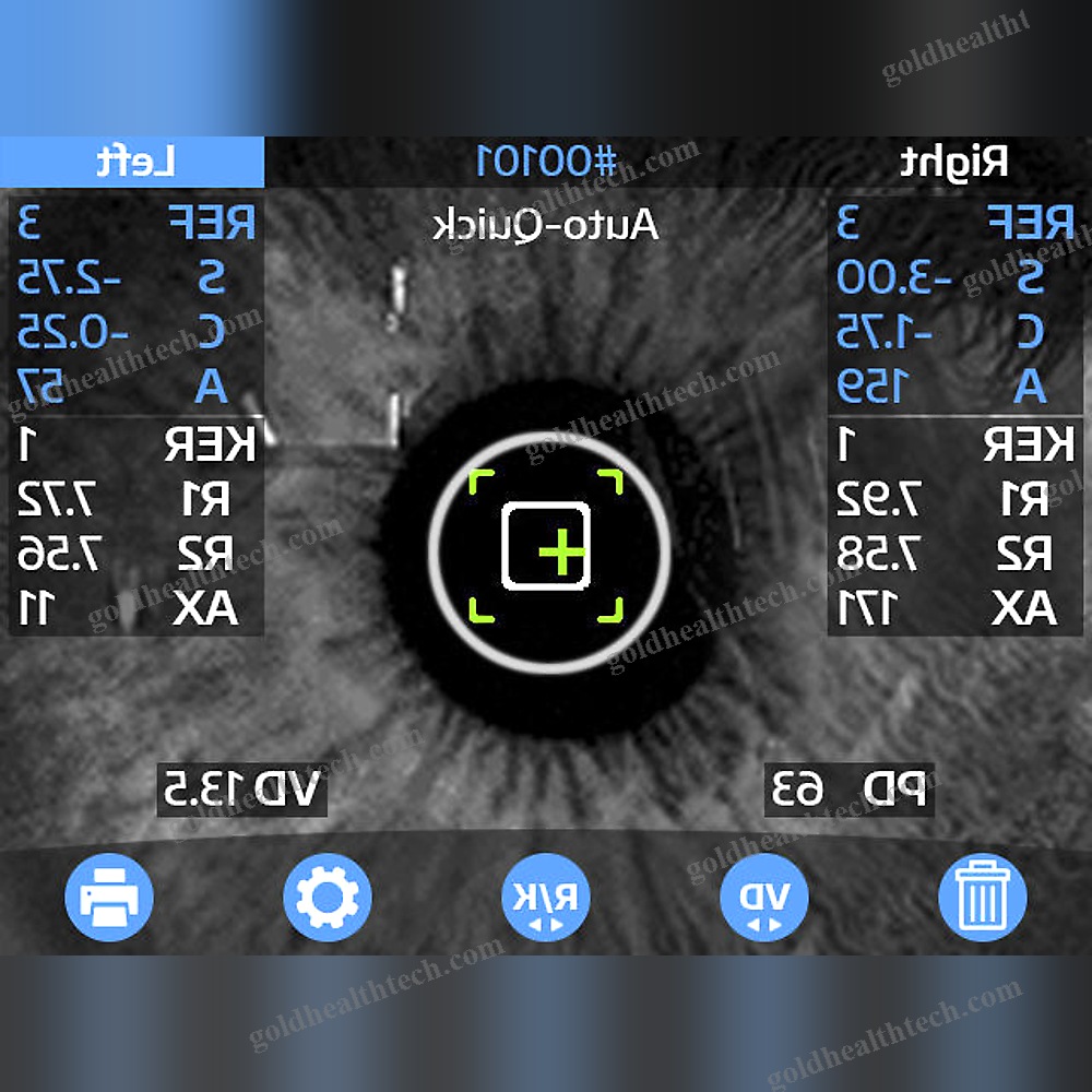 Video Pupillometer