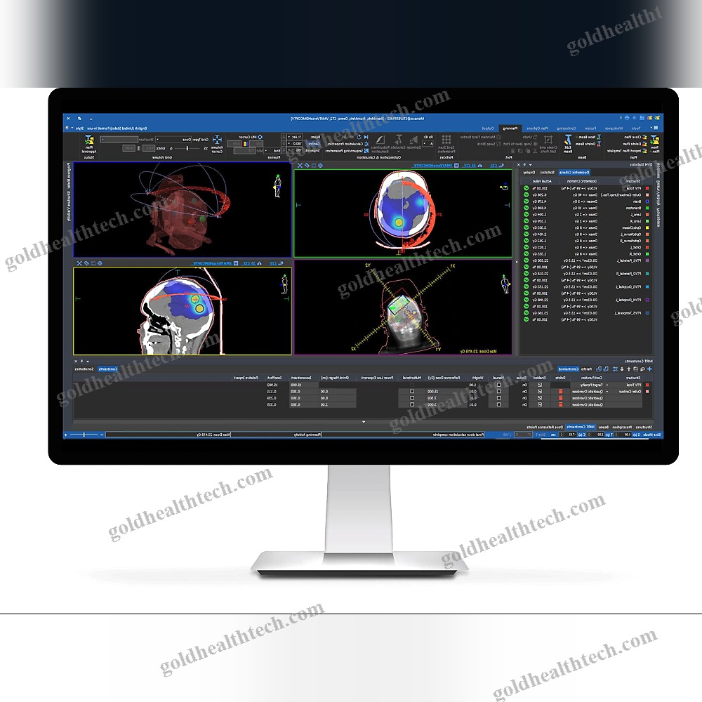 Treatment Planning Software