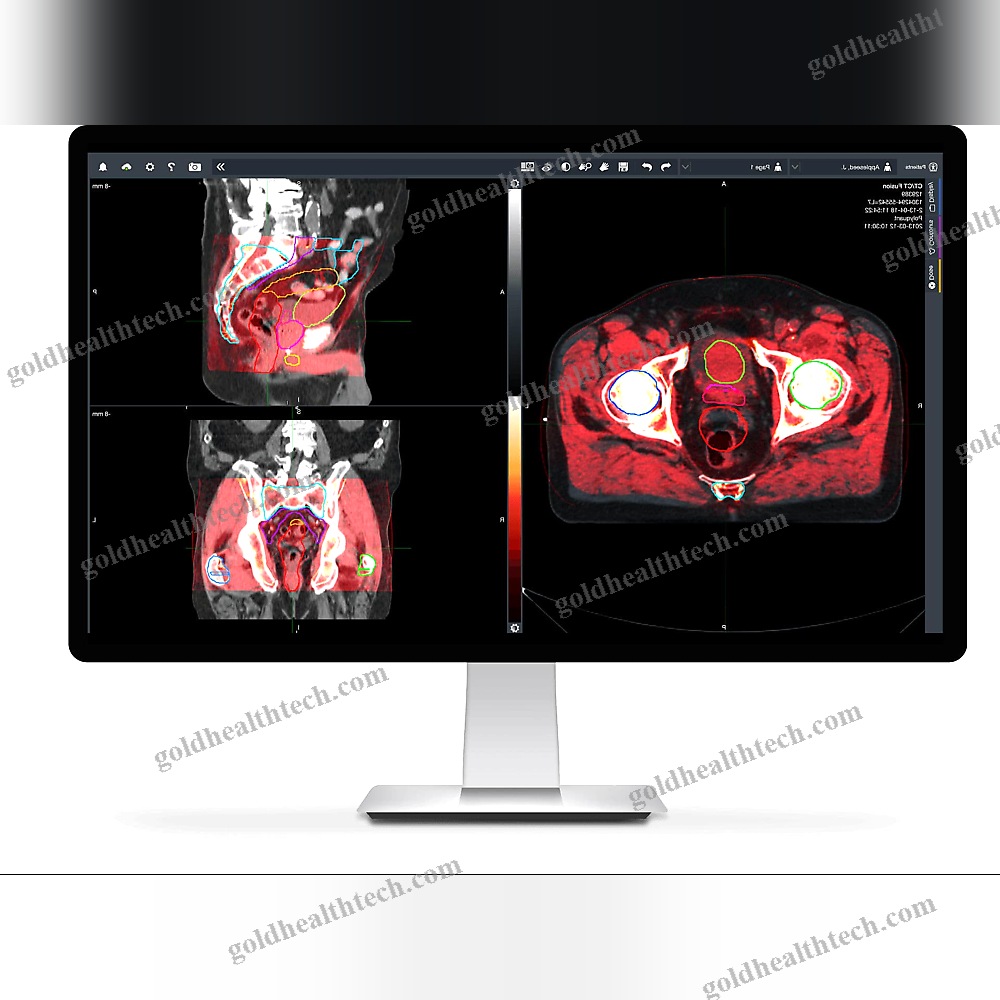Treatment Planning Software