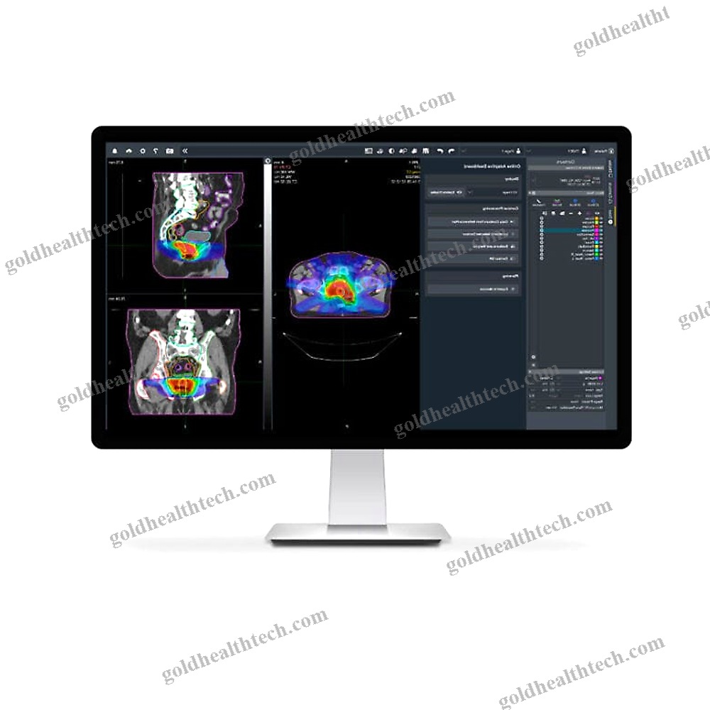 Treatment Planning Software