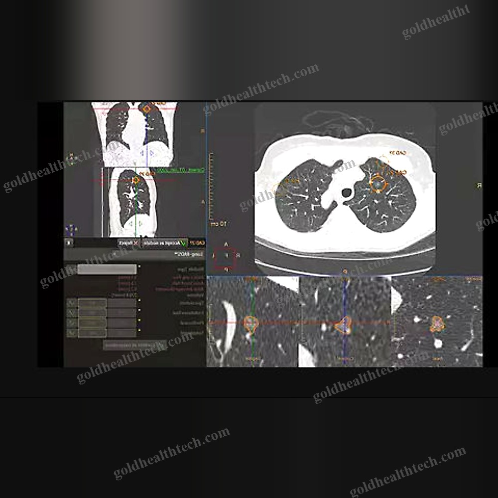 Medical Software
