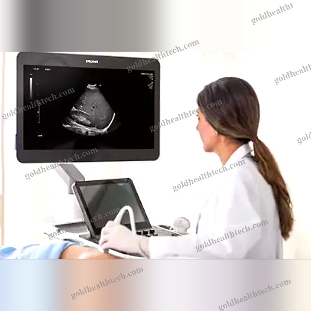 On-Platform Ultrasound System